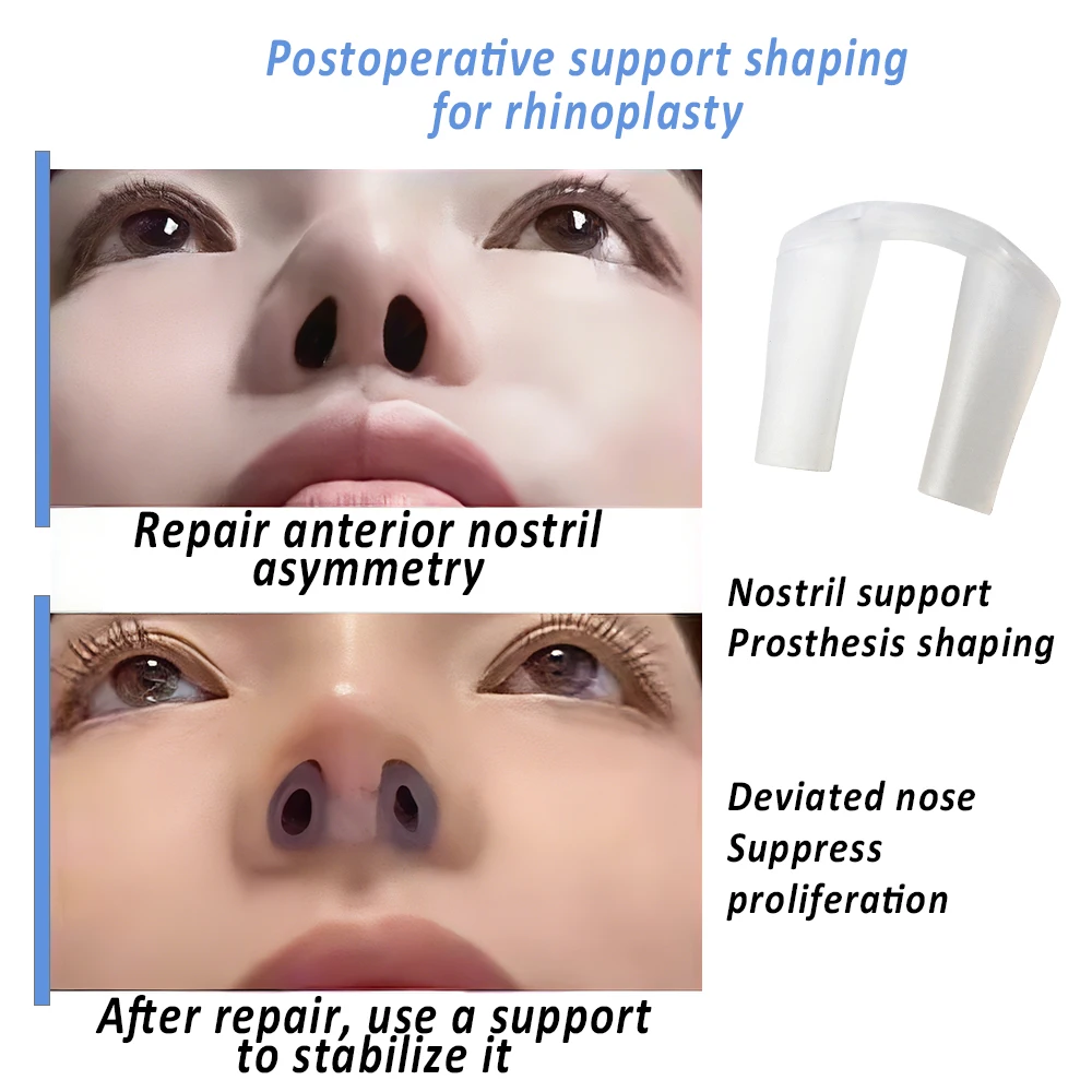 Soporte postoperatorio para rh - Anti Snore Contour Pillow reseña y precio